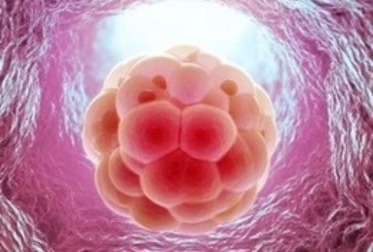 IVF