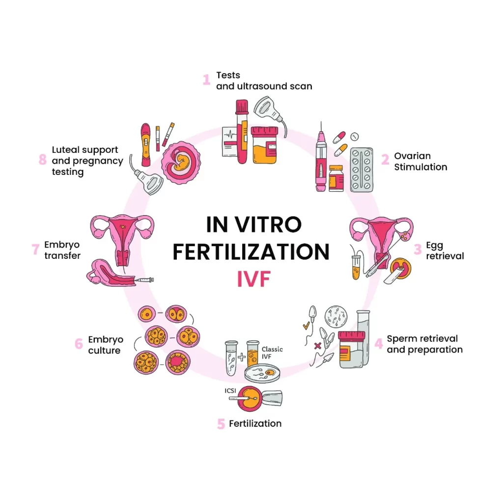 ivf (1)