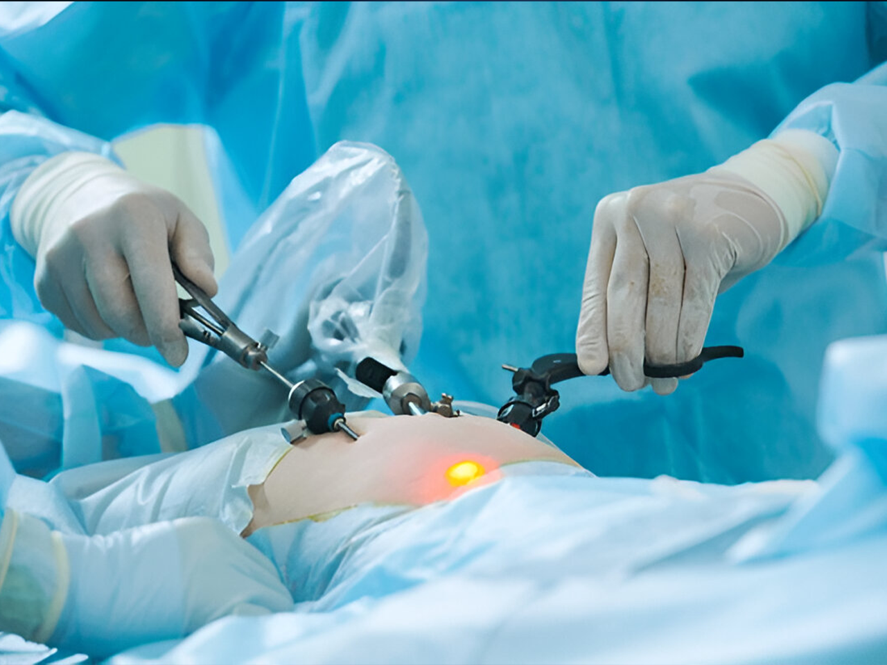 Top Laparoscopic Gynecologic Surgery in Kalkaji, South Delhi