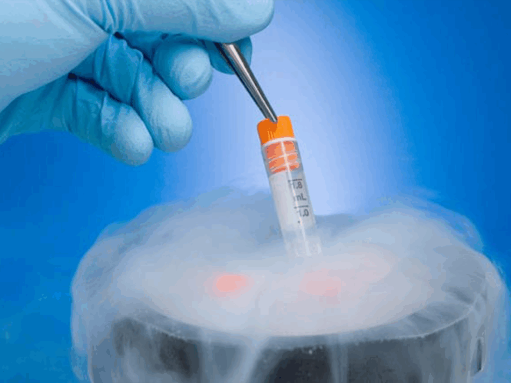 sperm_img