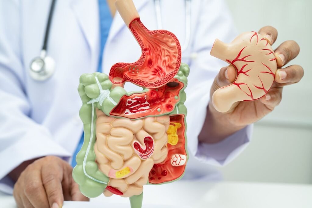 Gastrointestinal Health